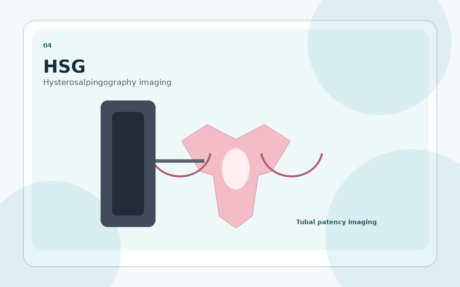 HSG diagnostic procedure