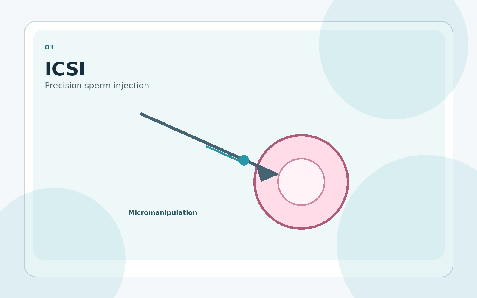 ICSI procedure